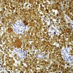 Anti-S100 antibody [4C4.9] used in IHC (Paraffin sections) (IHC-P). GTX24066